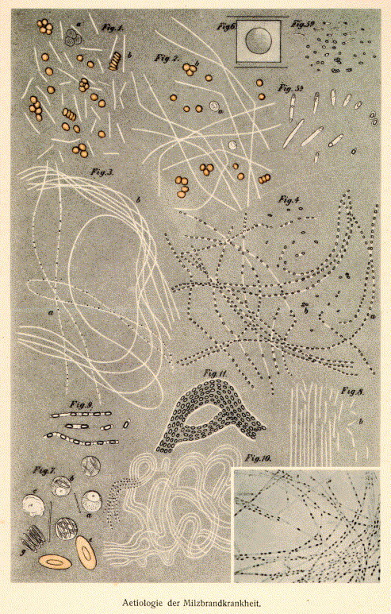 Aetiologie der Milzbrandkrankheit. Bild: Robert Koch, als gemeinfrei gekennzeichnet; https://commons.wikimedia.org/wiki/File:Aetiologie_der_Milzbrandkrankheit.jpg