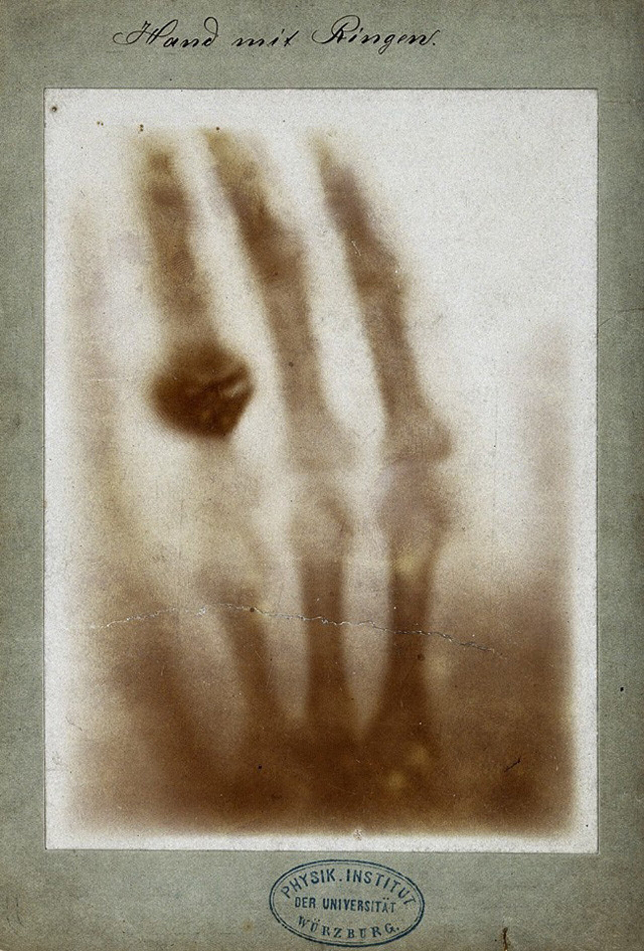 Foto: Wilhelm Röntgen, Public domain, via Wikimedia Commons <https://commons.wikimedia.org/wiki/File:First_medical_X-ray_by_Wilhelm_R%C3%B6ntgen_of_his_wife_Anna_Bertha_Ludwig%27s_hand_-_18951222.jpg">